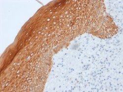 Cytokeratin 5/6/18 Antibody (LP34) - Azide and BSA Free, Novus Biologicals 100 &mu;g | Buy Online | Novus Biologicals | Fisher Scientific